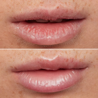 Last Day Buy 1 Get 1 Free Lip Oil Rehab Serum - Tinted Lip Oil, Hydrating, Moisturizing, and Non-Sticky Coral Pink Tint Serum for Dry Lips