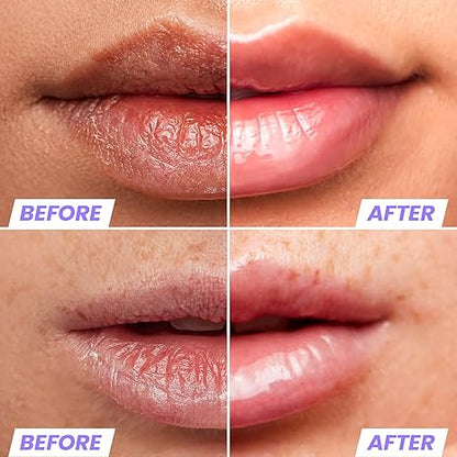 Last Day Buy 1 Get 1 Free Lip Oil Rehab Serum - Tinted Lip Oil, Hydrating, Moisturizing, and Non-Sticky Coral Pink Tint Serum for Dry Lips
