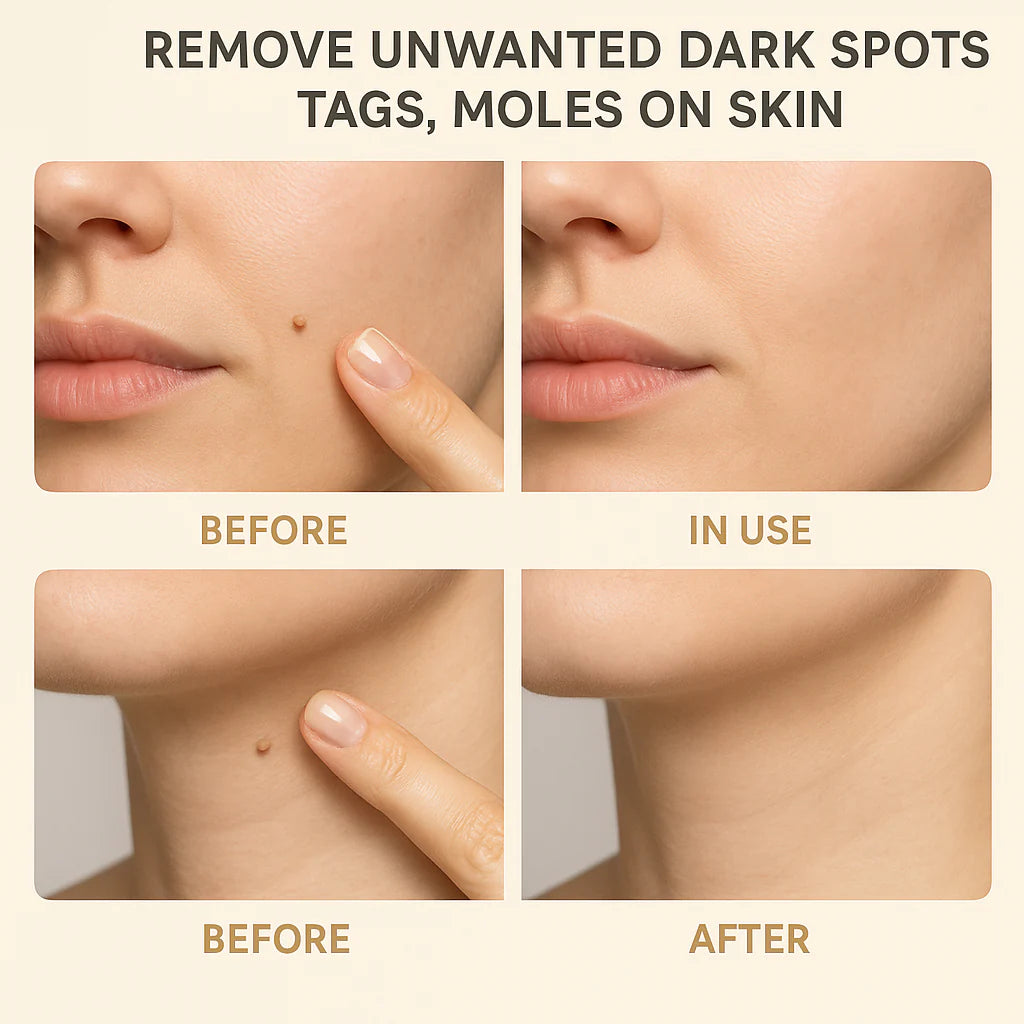 Organic Skin Tag Remover Serum | All Natural For Warts
