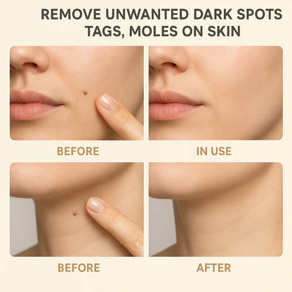 Organic Skin Tag Remover Serum | All Natural For Warts