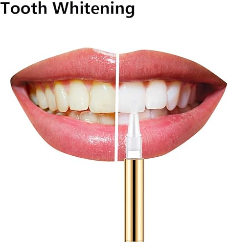 Teeth Whitening Pen - Powerful Stain Remover for Whiter & Brighter Teeth