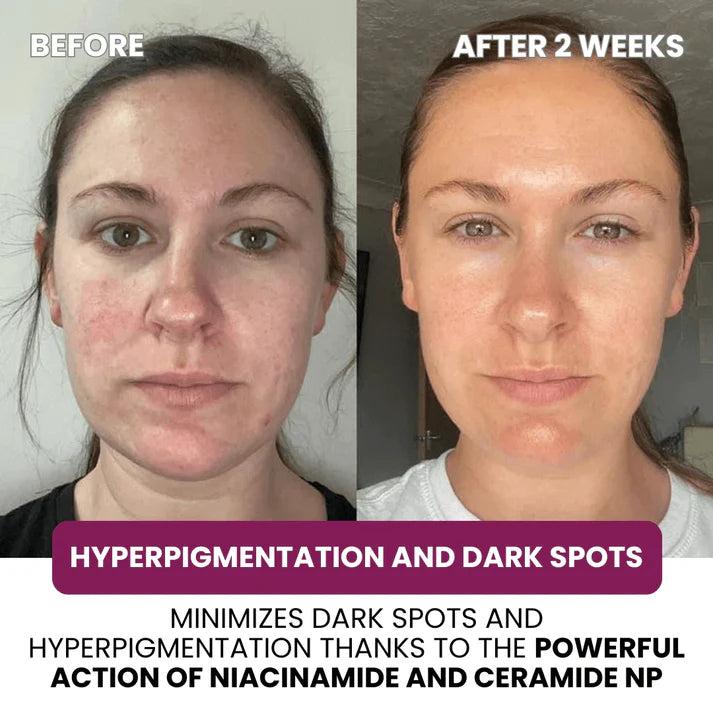 VIARELINE regenerating Mask with Hydrolyzed Collagen and Niacinamide（副本）