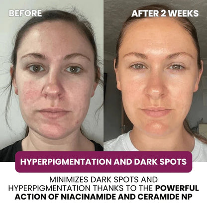 VIARELINE regenerating Mask with Hydrolyzed Collagen and Niacinamide（副本）