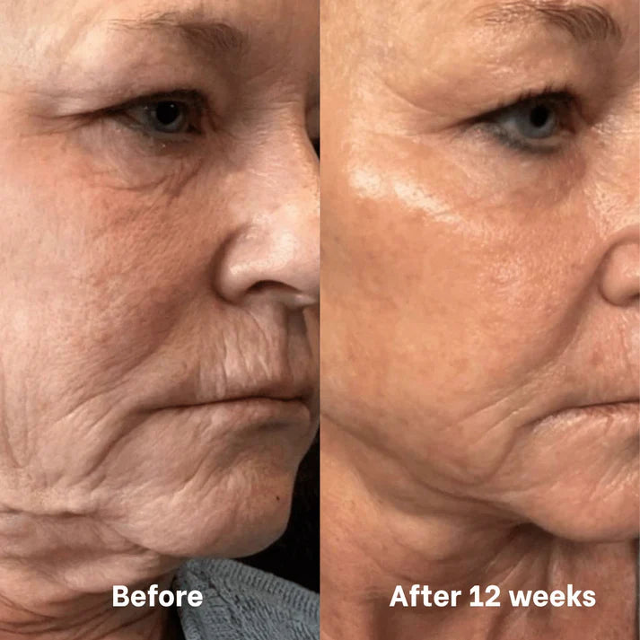VIARELINE regenerating Mask with Hydrolyzed Collagen and Niacinamide（副本）