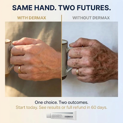 DERMAX Age Spot Corrector
